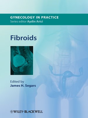 cover image of Fibroids